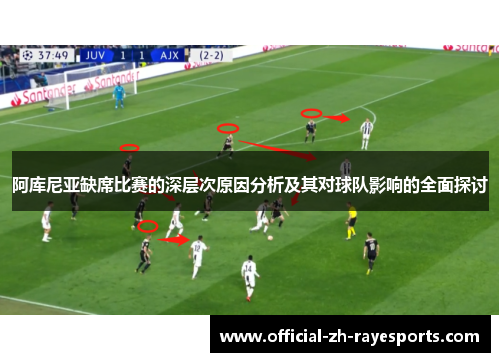 阿库尼亚缺席比赛的深层次原因分析及其对球队影响的全面探讨